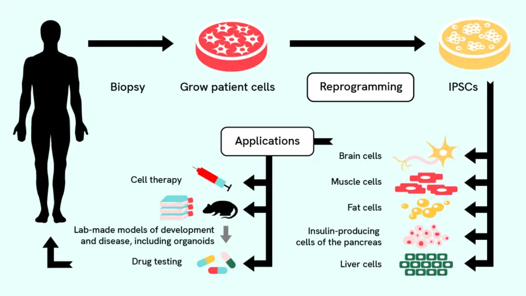 Un diagramma di flusso che mostra il processo di creazione di cellule staminali pluripotenti indotte a partire da cellule adulte