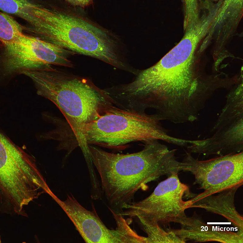 Cellule staminali mesenchimali derivate dal cordone ombelicale (UCMSC)